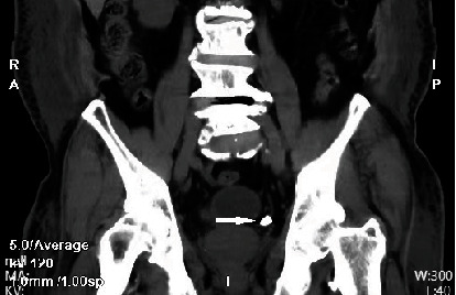Figure 9