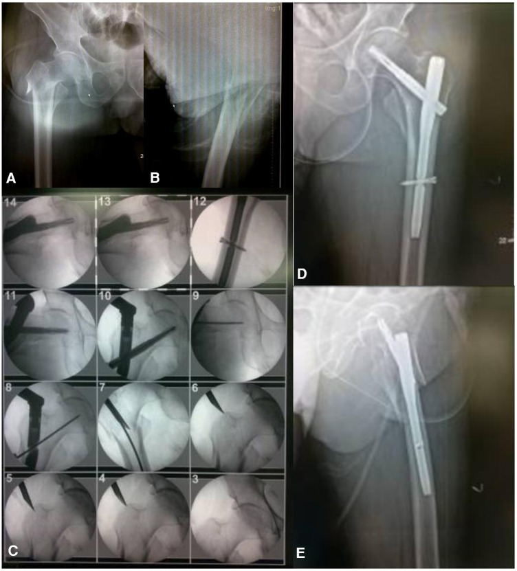 Figure 10