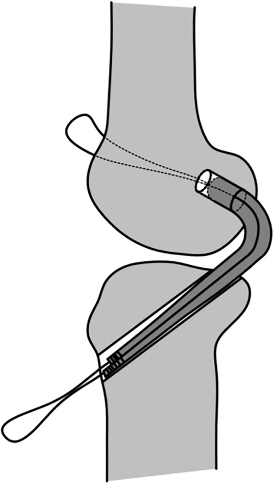 Fig 9