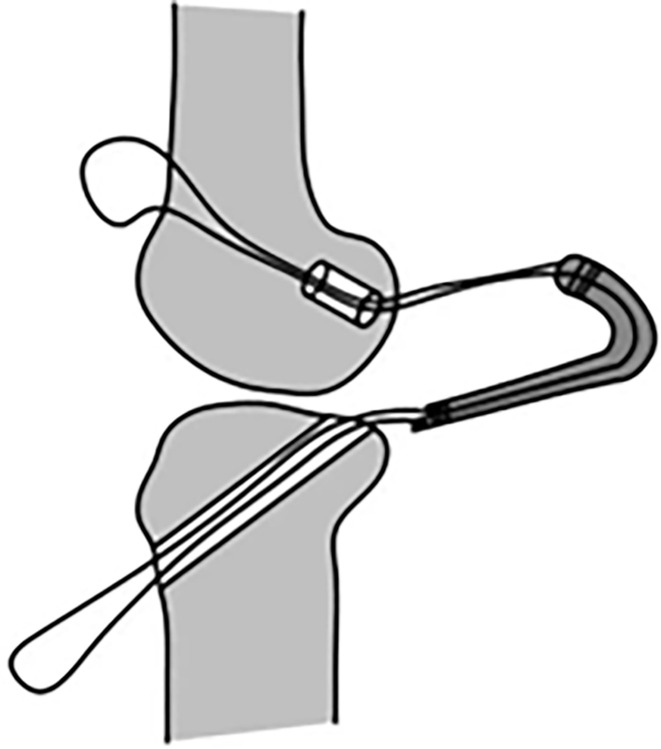 Fig 10