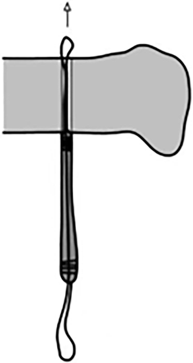 Fig 11