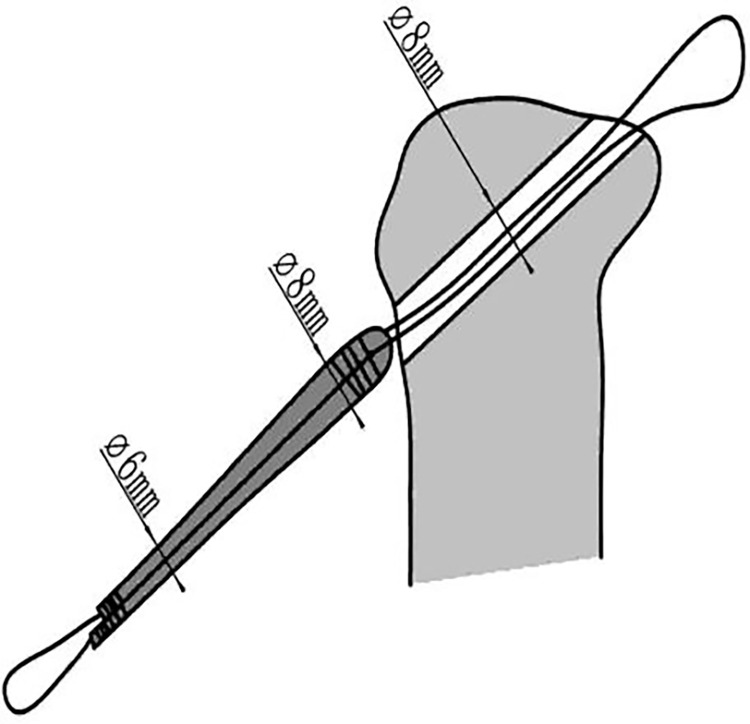 Fig 12