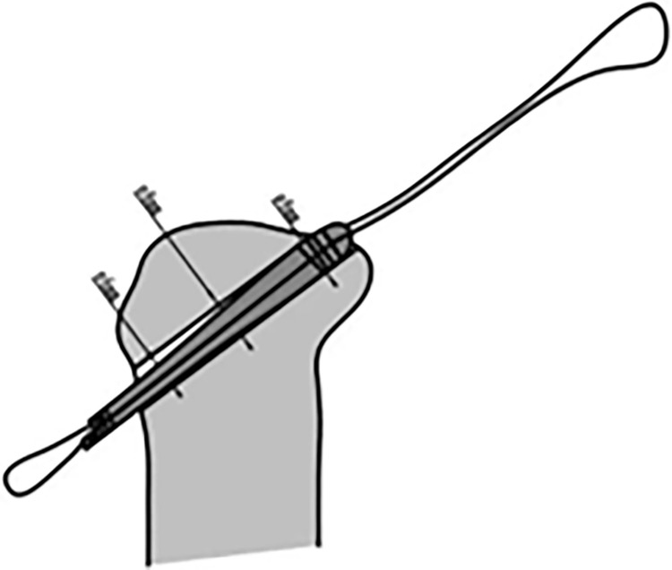 Fig 13