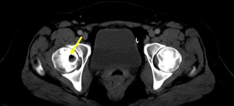 Figure 6