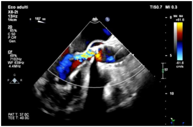Fig. 1