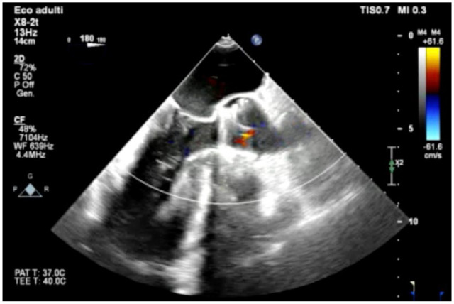 Fig. 2