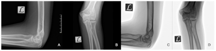 Figure 10