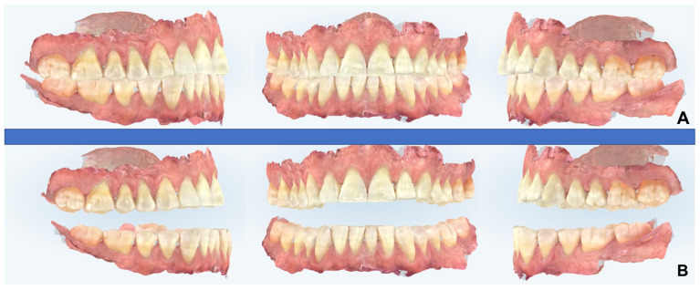 Figure 11