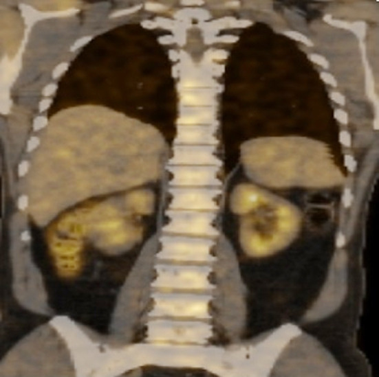Fig.1