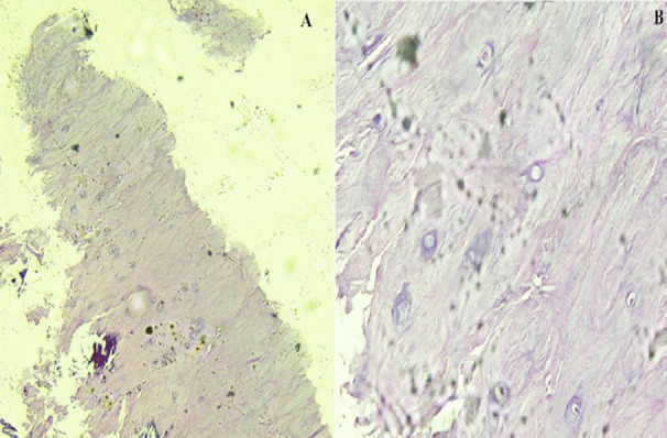 Fig.2