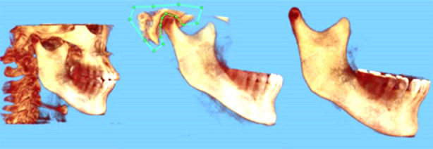 Fig.1