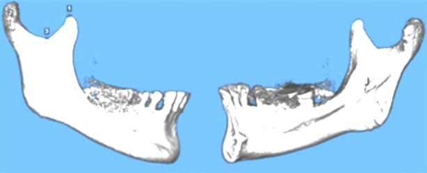 Fig.2