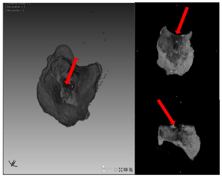 Figure 6