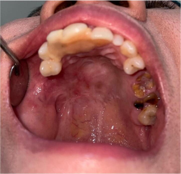 Figure 9