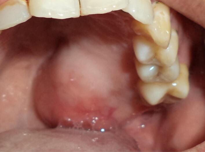 Figure 11