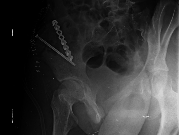 Figure 7