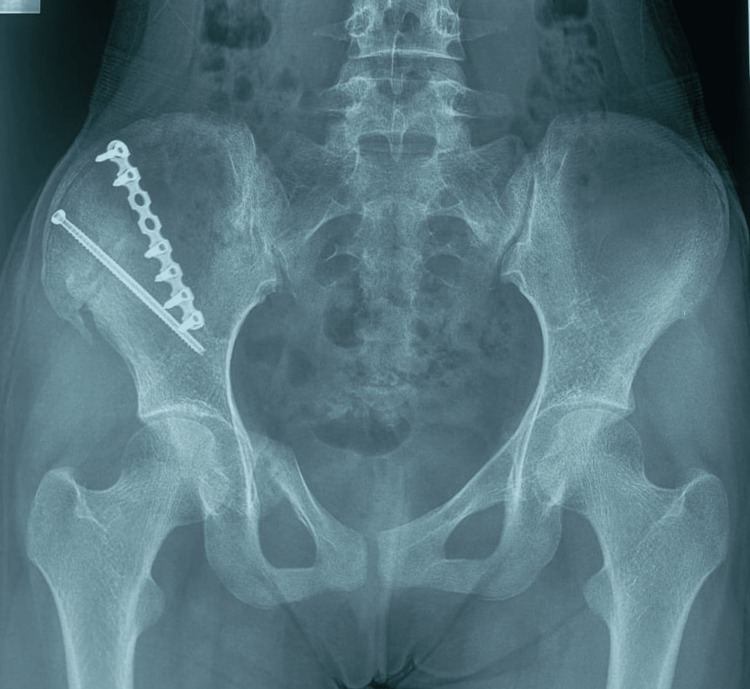 Figure 8