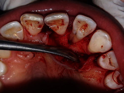 Figure 6