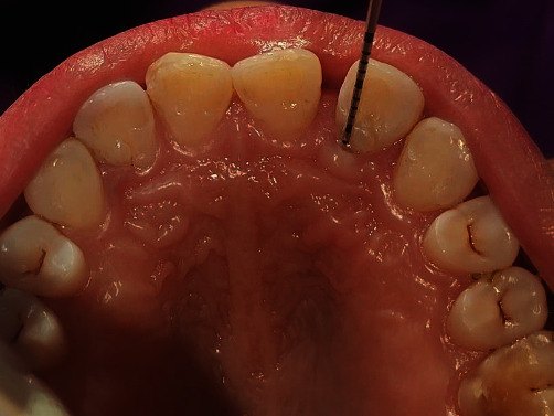 Figure 11