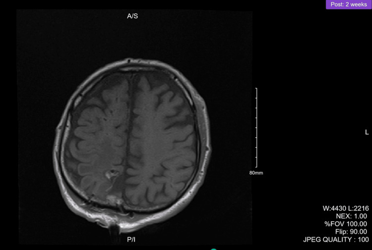 Figure 5
