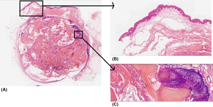 FIGURE 3