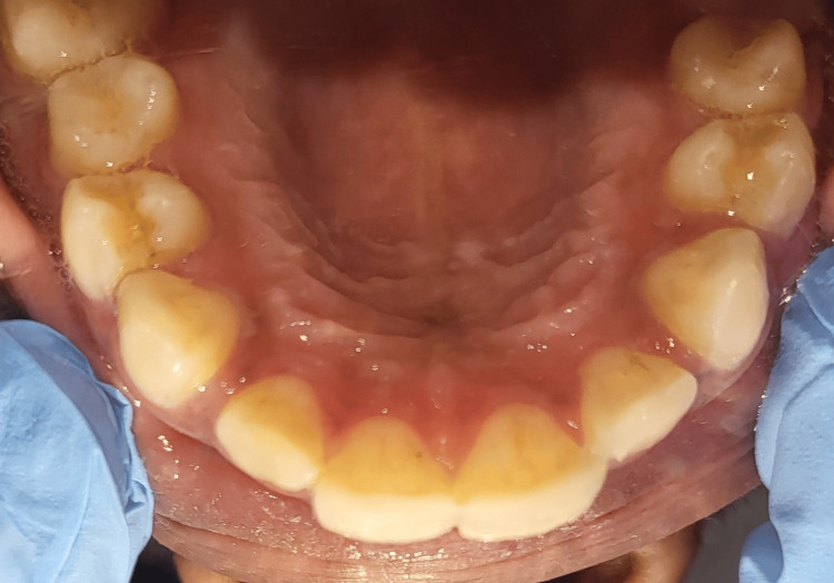 Figure 17