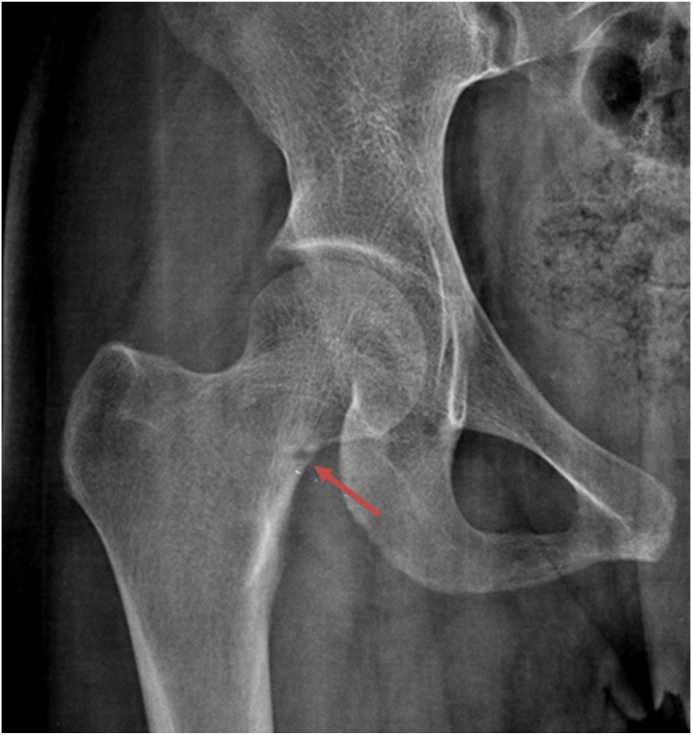 Figure 6