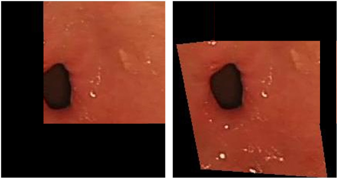Figure 34