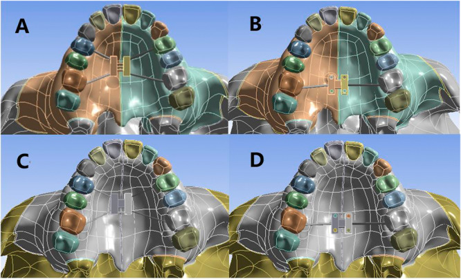 Figure 11