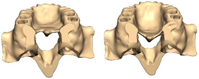 Figure 12