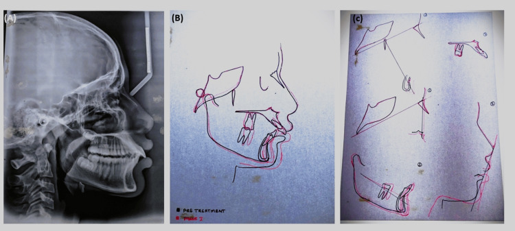 Figure 9