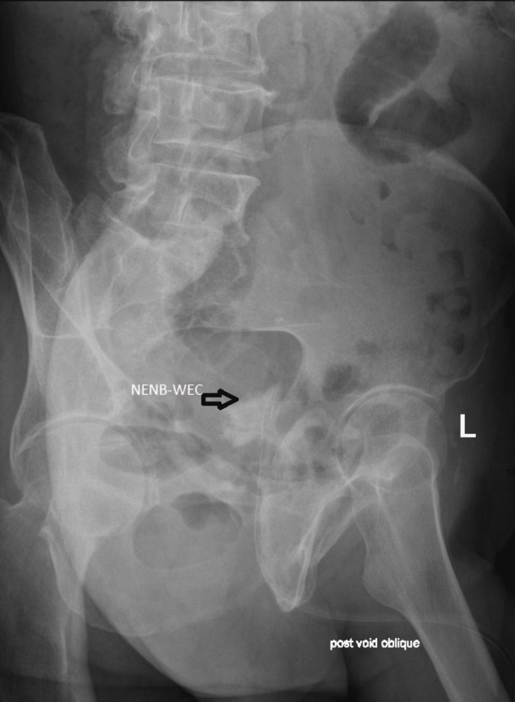 Figure 9