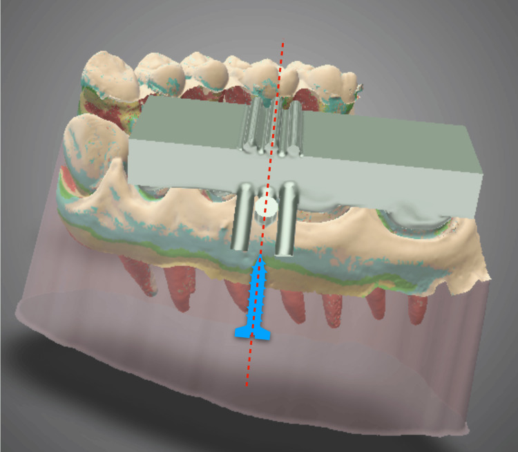 Figure 5