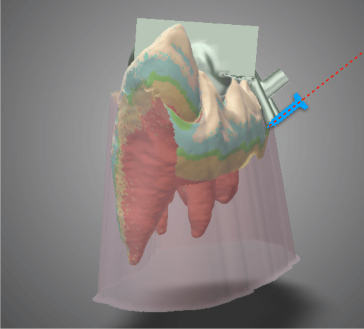 Figure 6