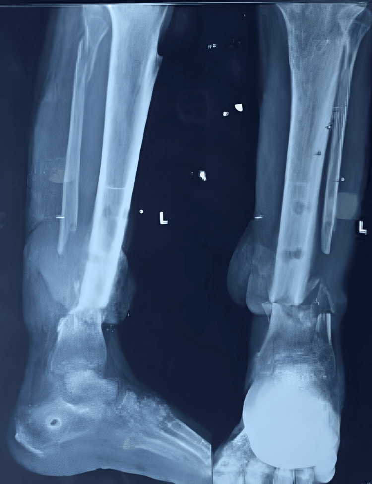 Figure 4