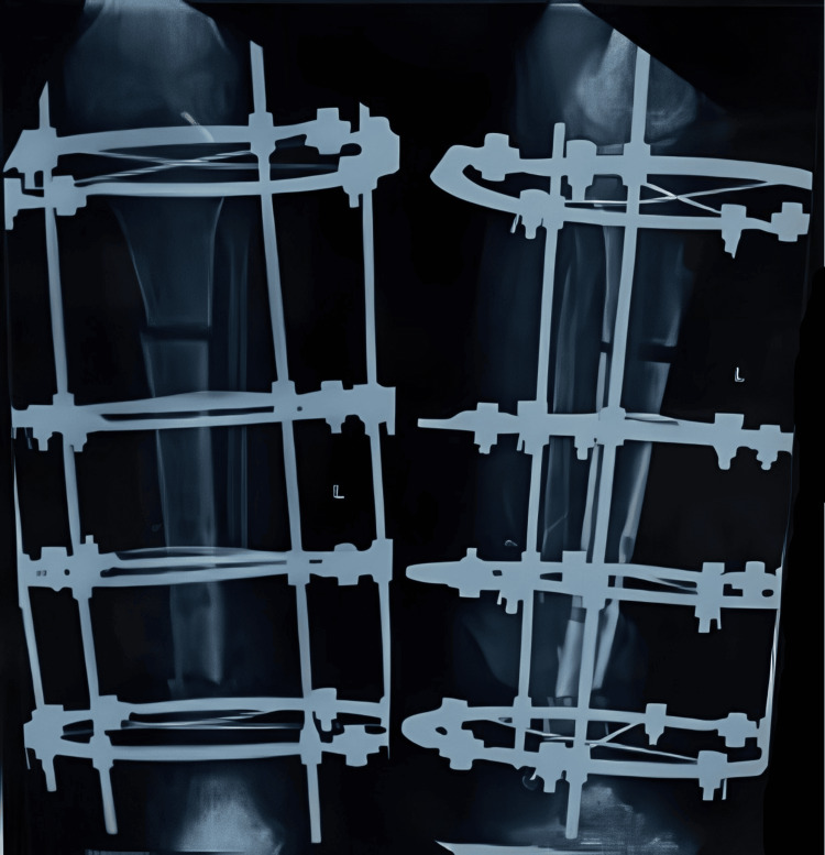 Figure 6