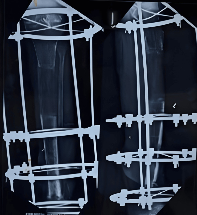 Figure 9