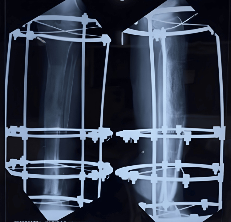 Figure 11