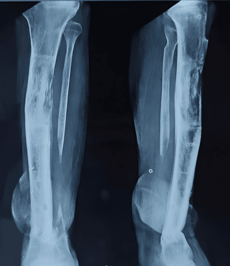 Figure 12
