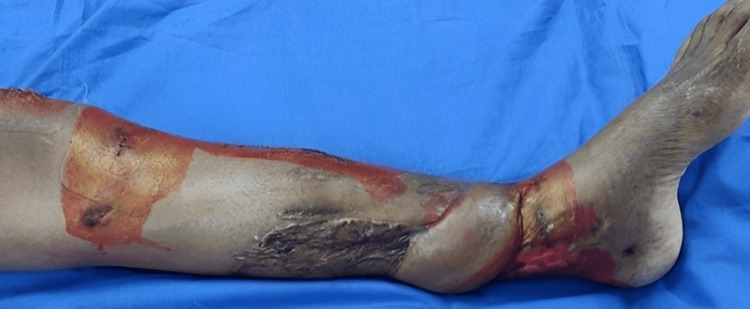 Figure 13