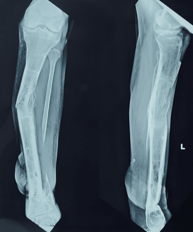 Figure 14