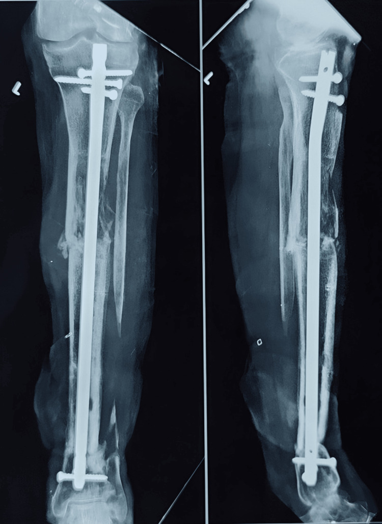 Figure 16