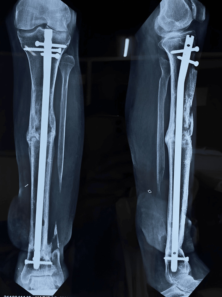 Figure 17