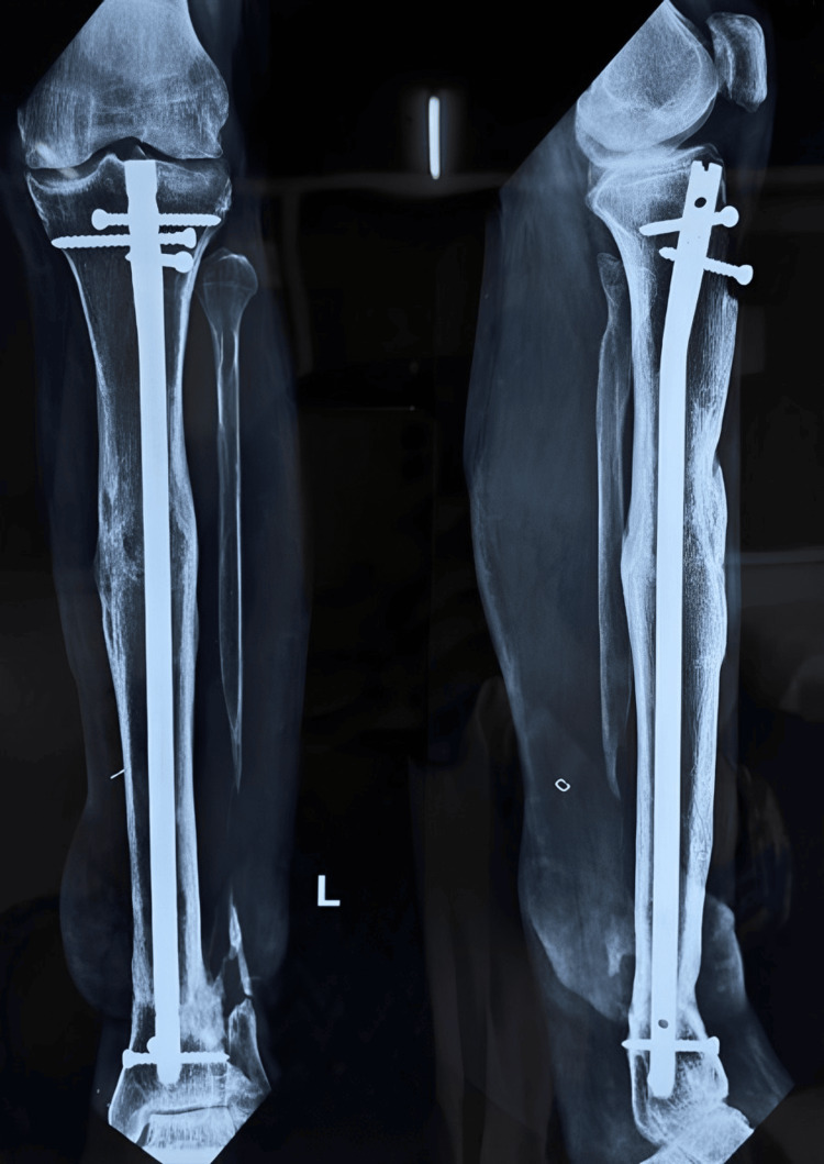 Figure 18