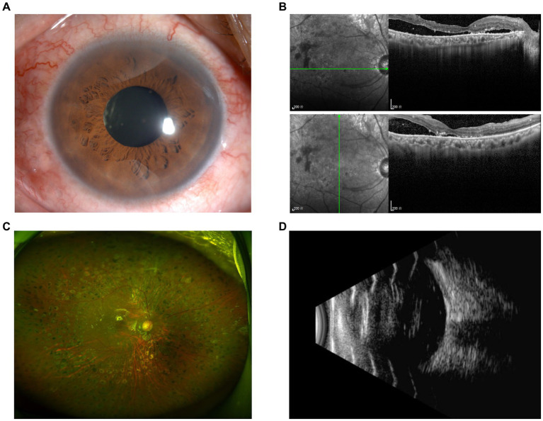 Figure 6
