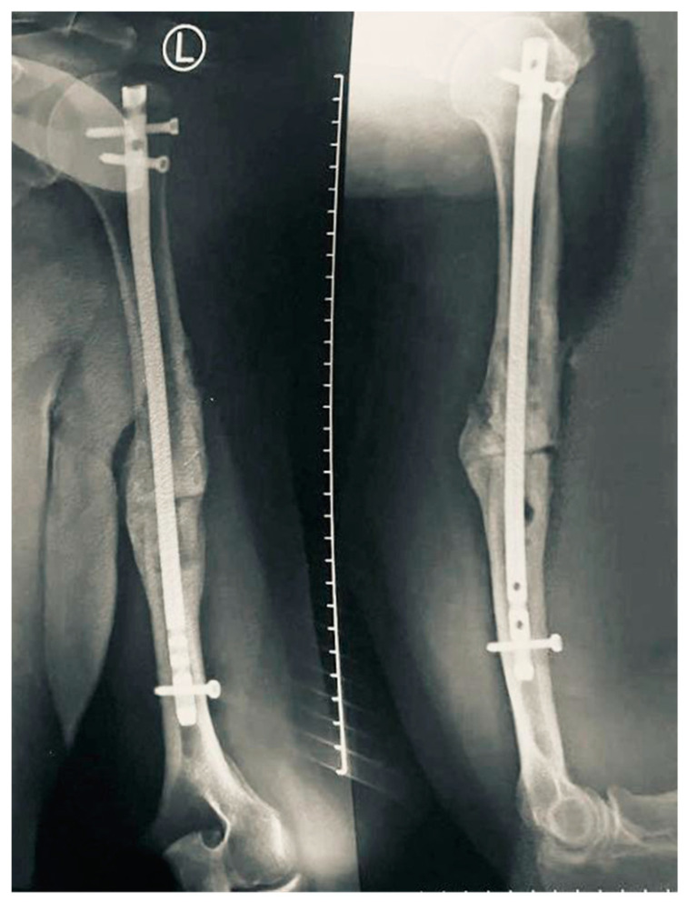Figure 4