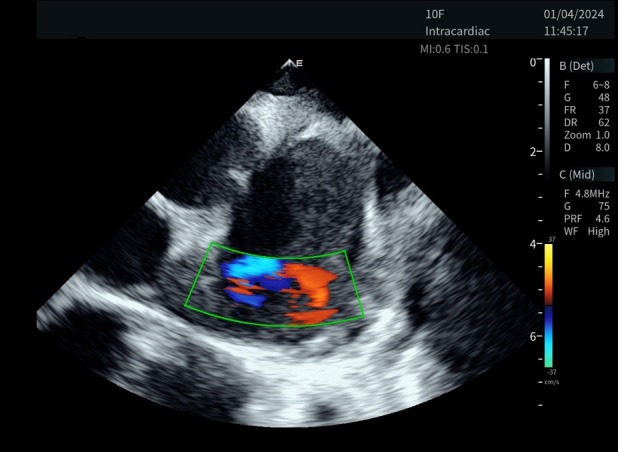 Figure 2