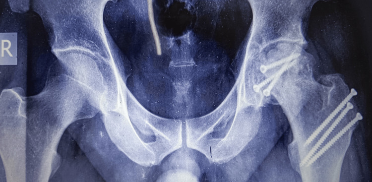 Figure 13