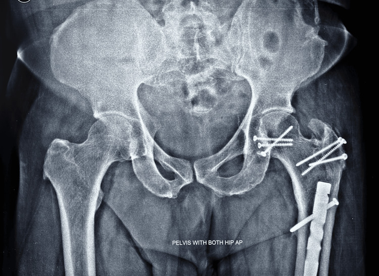 Figure 15