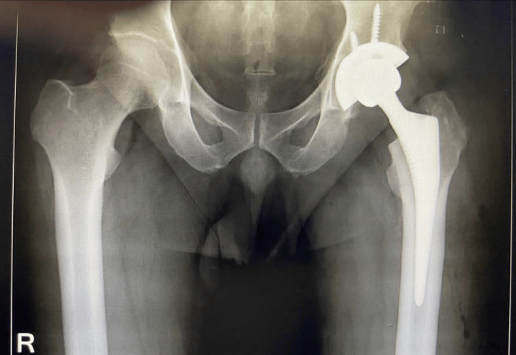 Figure 17
